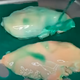 A screenshot of a YouTube video where chicken is covered in green NyQuil on a skillet.